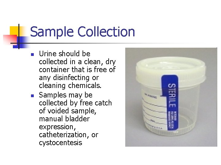 Sample Collection n n Urine should be collected in a clean, dry container that