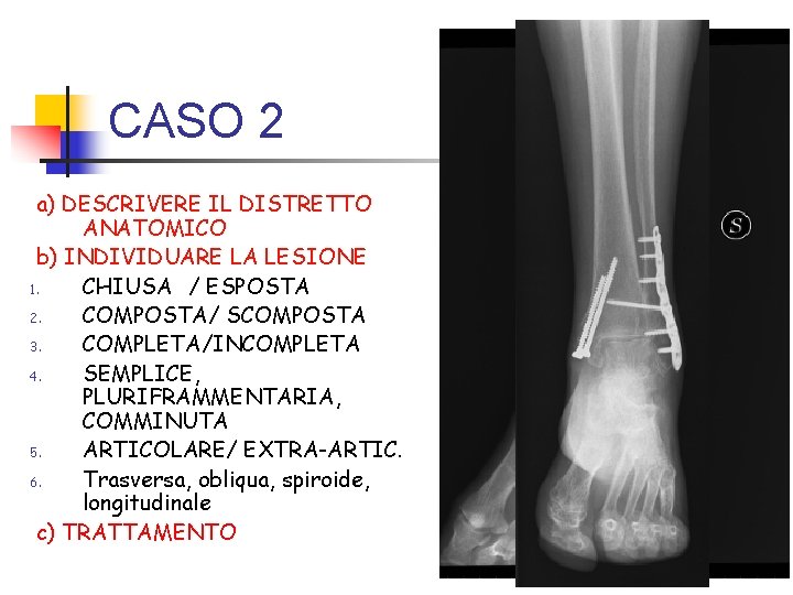 CASO 2 a) DESCRIVERE IL DISTRETTO ANATOMICO b) INDIVIDUARE LA LESIONE 1. CHIUSA /