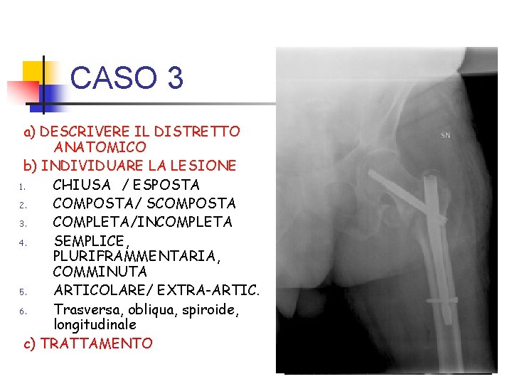CASO 3 a) DESCRIVERE IL DISTRETTO ANATOMICO b) INDIVIDUARE LA LESIONE 1. CHIUSA / CASO 3 a) DESCRIVERE IL DISTRETTO ANATOMICO b) INDIVIDUARE LA LESIONE 1. CHIUSA /