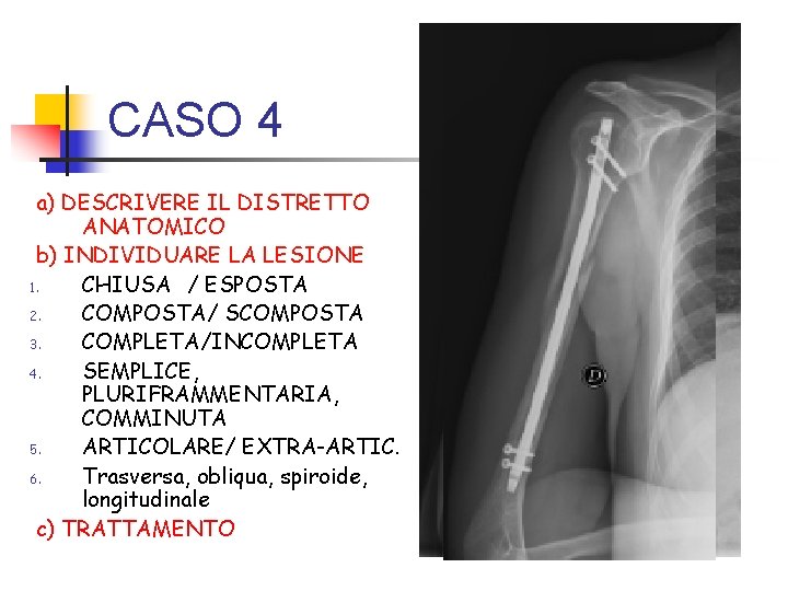 CASO 4 a) DESCRIVERE IL DISTRETTO ANATOMICO b) INDIVIDUARE LA LESIONE 1. CHIUSA /