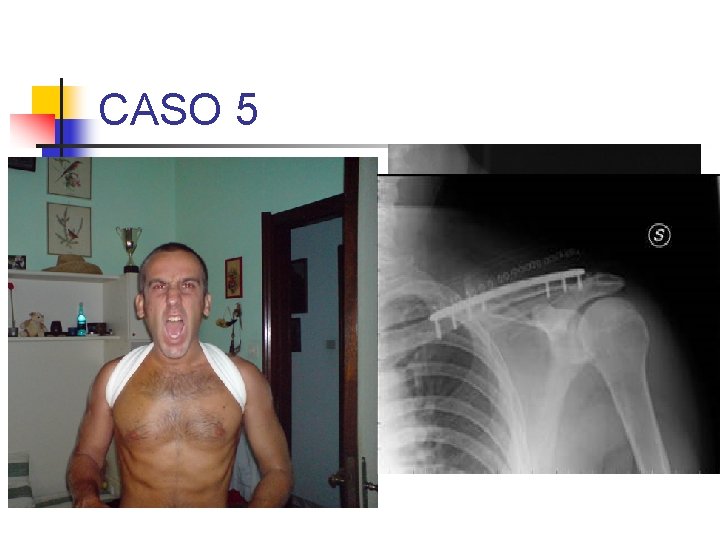 CASO 5 a) DESCRIVERE IL DISTRETTO ANATOMICO b) INDIVIDUARE LA LESIONE 1. CHIUSA / CASO 5 a) DESCRIVERE IL DISTRETTO ANATOMICO b) INDIVIDUARE LA LESIONE 1. CHIUSA /