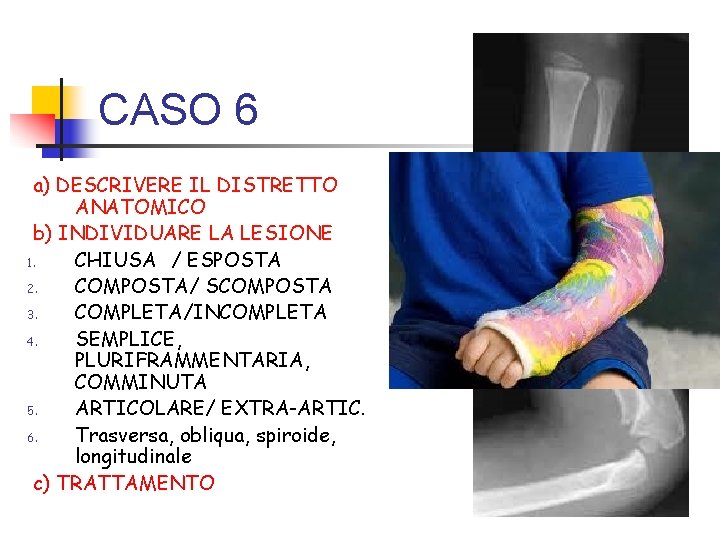 CASO 6 a) DESCRIVERE IL DISTRETTO ANATOMICO b) INDIVIDUARE LA LESIONE 1. CHIUSA /