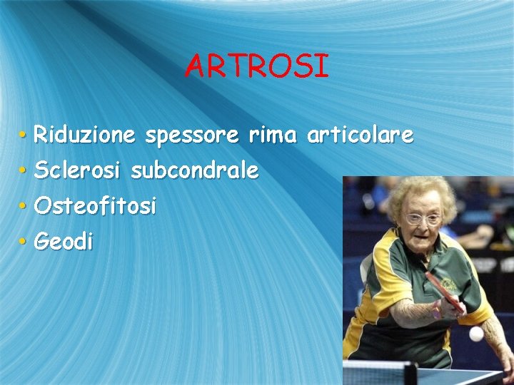 ARTROSI • Riduzione spessore rima articolare • Sclerosi subcondrale • Osteofitosi • Geodi 