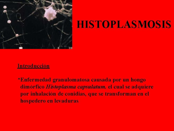 HISTOPLASMOSIS Introducción *Enfermedad granulomatosa causada por un hongo dimórfico Histoplasma capsulatum, el cual se