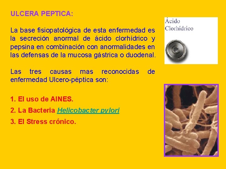 ULCERA PEPTICA: La base fisiopatológica de esta enfermedad es la secreción anormal de ácido