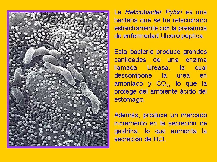 La Helicobacter Pylori es una bacteria que se ha relacionado estrechamente con la presencia