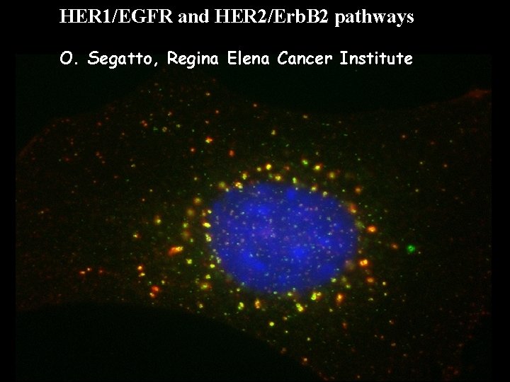 HER 1/EGFR and HER 2/Erb. B 2 pathways O. Segatto, Regina Elena Cancer Institute