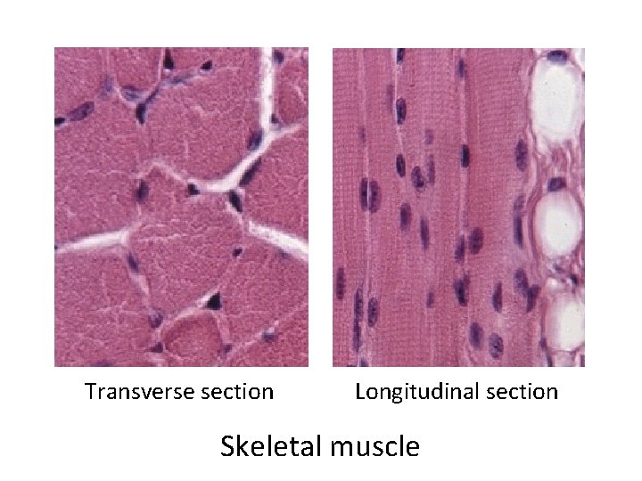 Transverse section Longitudinal section Skeletal muscle 