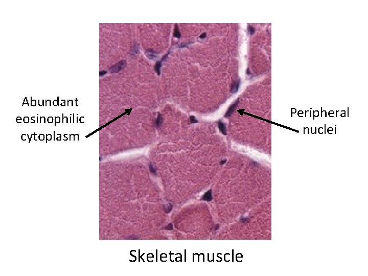 Abundant eosinophilic cytoplasm Peripheral nuclei Skeletal muscle 