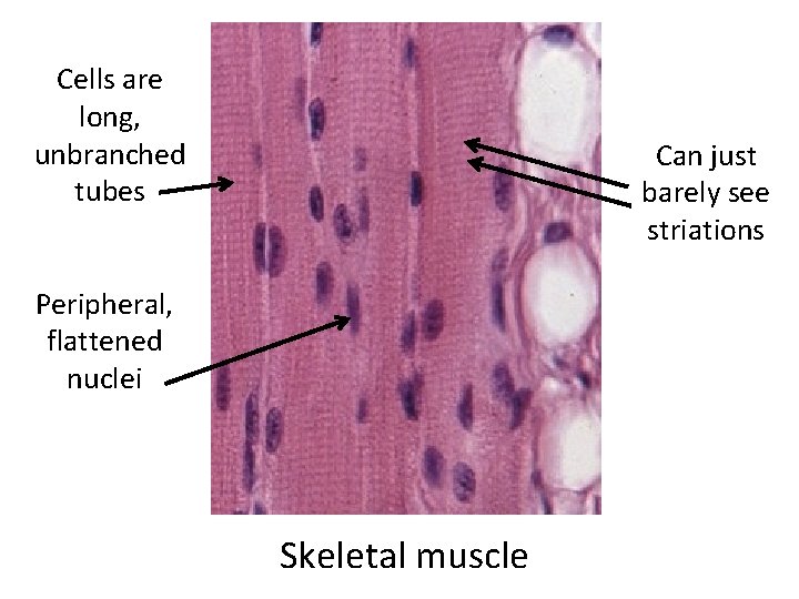 Cells are long, unbranched tubes Can just barely see striations Peripheral, flattened nuclei Skeletal