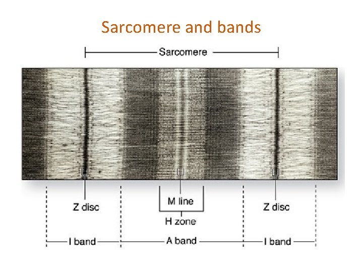 Sarcomere and bands 