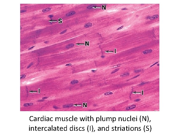 Cardiac muscle with plump nuclei (N), intercalated discs (I), and striations (S) 