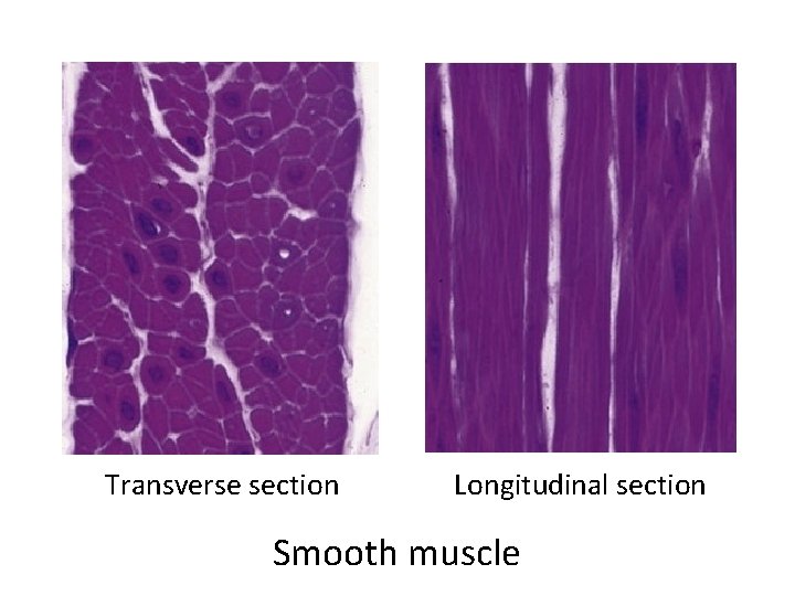 Transverse section Longitudinal section Smooth muscle 