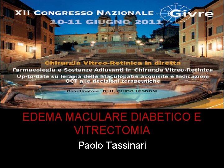 EDEMA MACULARE DIABETICO E VITRECTOMIA Paolo Tassinari 