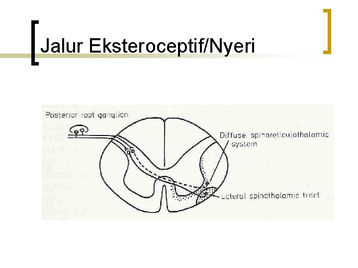 Jalur Eksteroceptif/Nyeri 