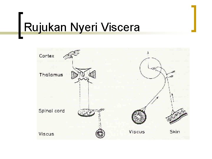 Rujukan Nyeri Viscera 