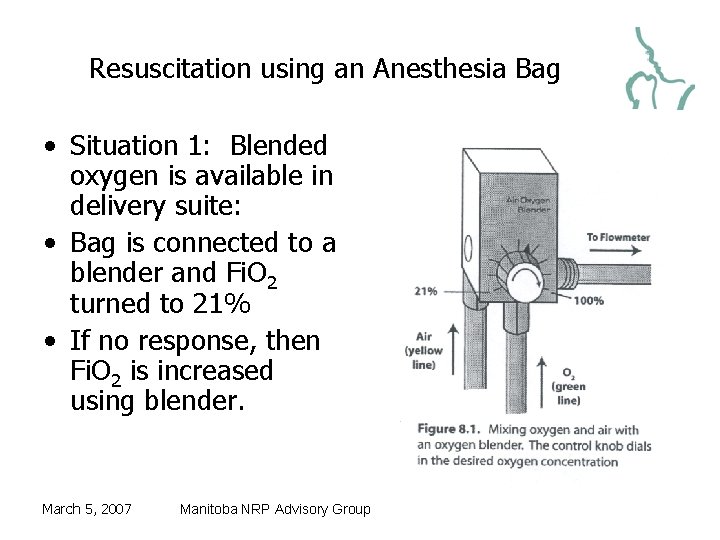 Resuscitation using an Anesthesia Bag • Situation 1: Blended oxygen is available in delivery