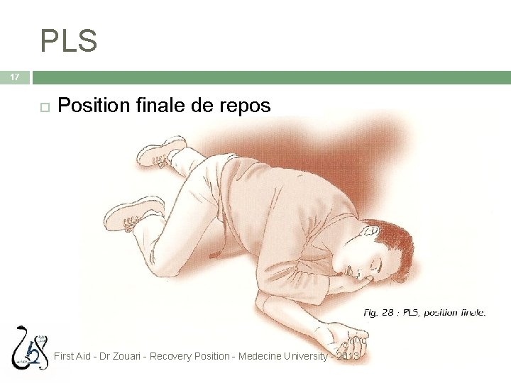 PLS 17 Position finale de repos First Aid - Dr Zouari - Recovery Position