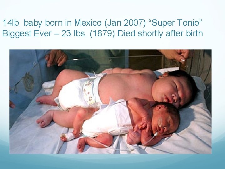 14 lb baby born in Mexico (Jan 2007) “Super Tonio” Biggest Ever – 23