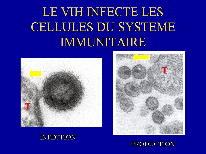 LE VIH INFECTE LES CELLULES DU SYSTEME IMMUNITAIRE T T INFECTION PRODUCTION 