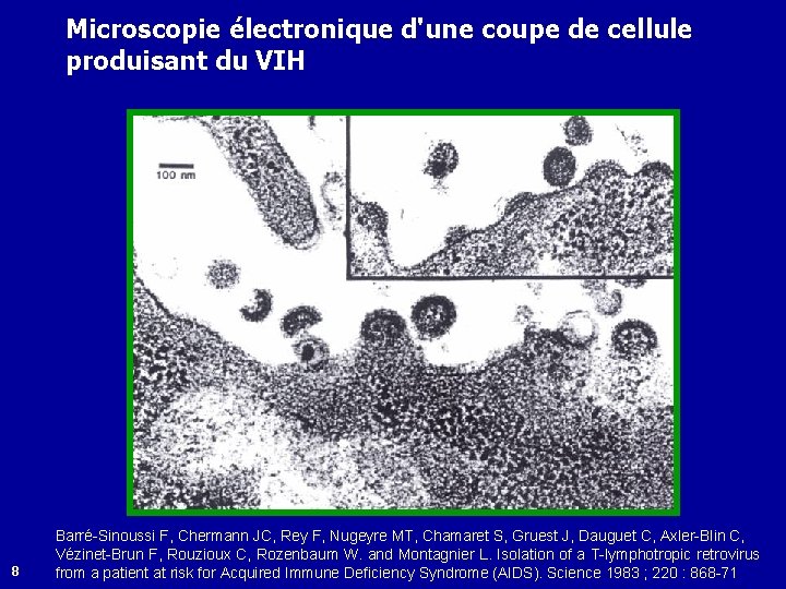 Microscopie électronique d'une coupe de cellule produisant du VIH 8 Barré-Sinoussi F, Chermann JC,