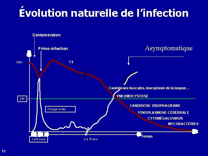 Évolution naturelle de l’infection Contamination Asymptomatique Primo-infection T 4 1000 Candidoses buccales, leucoplasie de