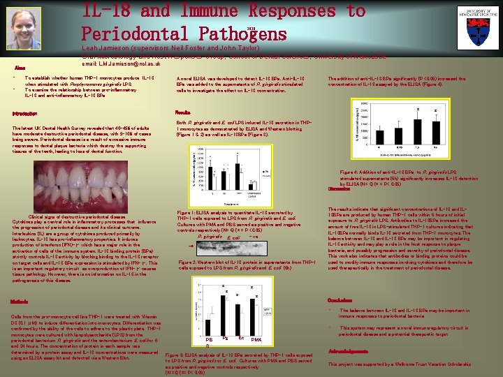 IL-18 and Immune Responses to Periodontal Pathogens 2020 Leah Jamieson (supervisors Neil Foster and