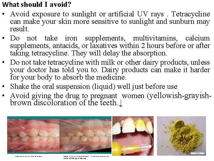 What should I avoid? • Avoid exposure to sunlight or artificial UV rays. Tetracycline