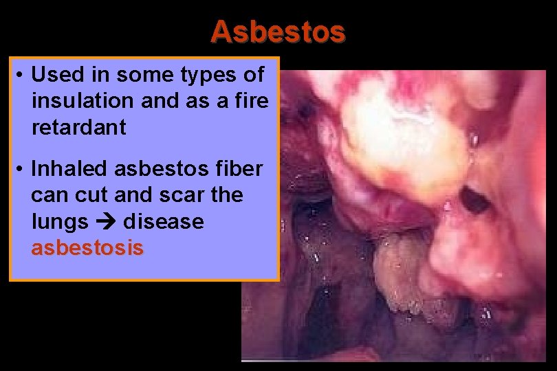 Asbestos • Used in some types of insulation and as a fire retardant •