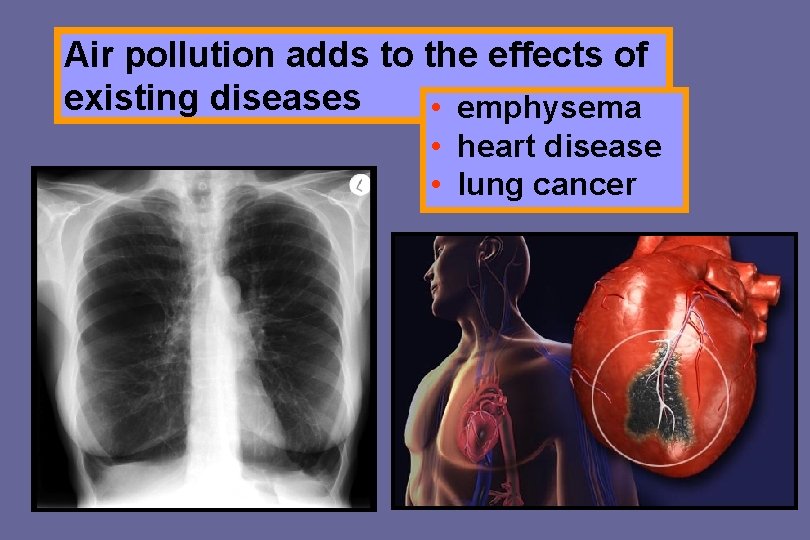 Air pollution adds to the effects of existing diseases • emphysema • heart disease