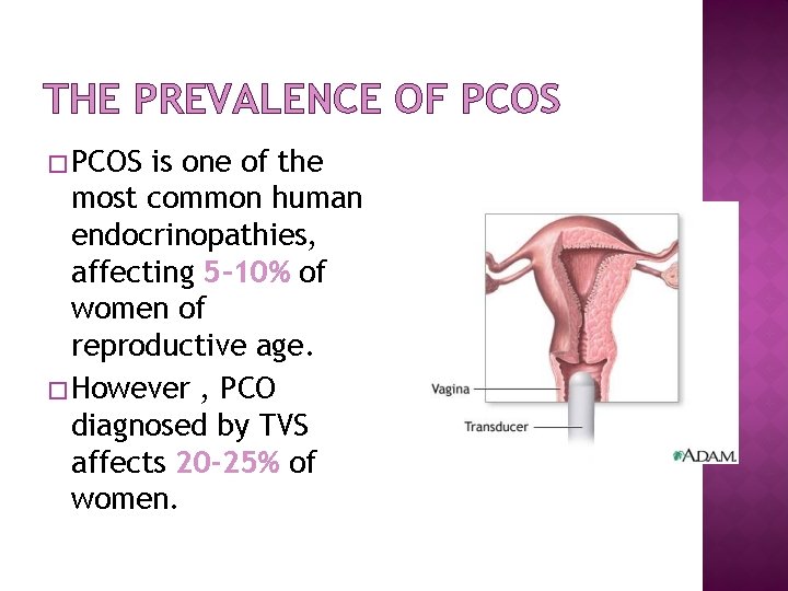 THE PREVALENCE OF PCOS � PCOS is one of the most common human endocrinopathies,