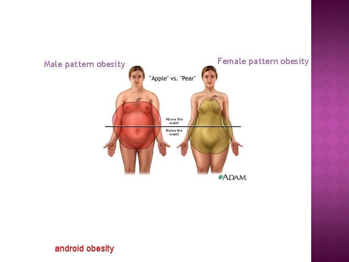 Male pattern obesity android obesity Female pattern obesity 