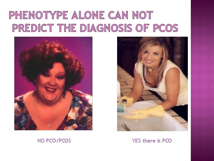 PHENOTYPE ALONE CAN NOT PREDICT THE DIAGNOSIS OF PCOS NO PCO/PCOS YES there is