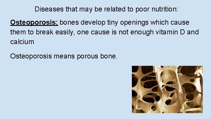 Diseases that may be related to poor nutrition: Osteoporosis: bones develop tiny openings which