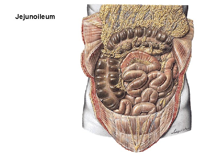 Jejunoileum Jejunoileum