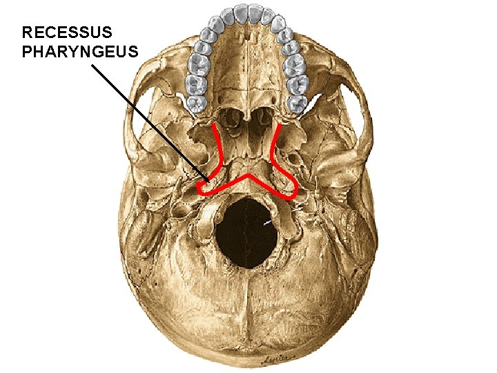 RECESSUS PHARYNGEUS RECESSUS PHARYNGEUS