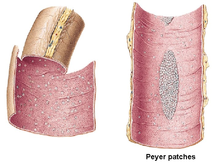 Peyer patches Peyer patches