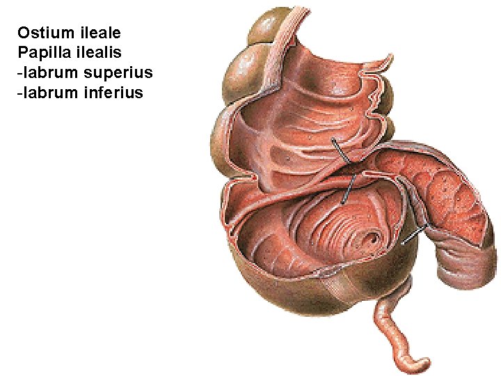 Ostium ileale Papilla ilealis -labrum superius -labrum inferius Ostium ileale Papilla ilealis -labrum superius -labrum inferius