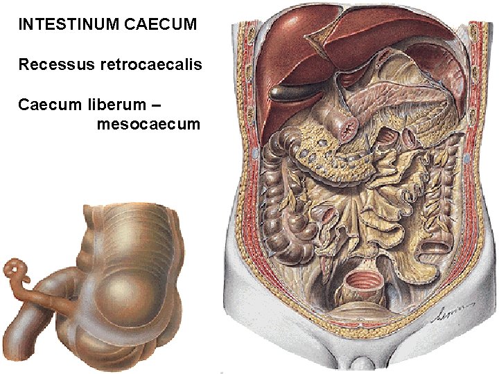 INTESTINUM CAECUM Recessus retrocaecalis Caecum liberum – mesocaecum INTESTINUM CAECUM Recessus retrocaecalis Caecum liberum – mesocaecum