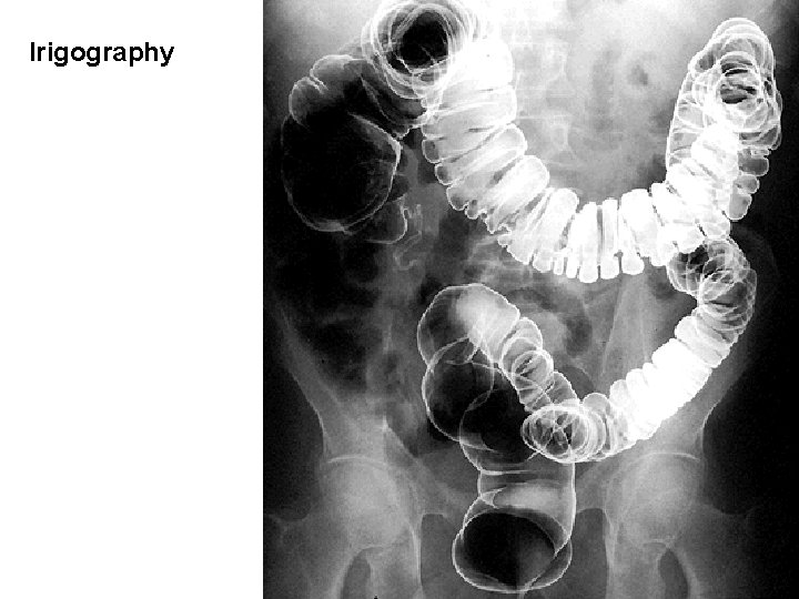 Irigography Irigography