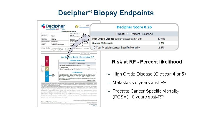 Decipher® Biopsy Endpoints Risk at RP - Percent likelihood – High Grade Disease (Gleason