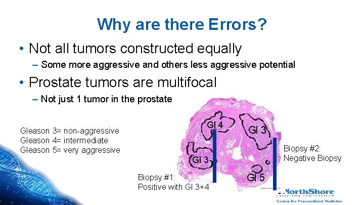 Why are there Errors? • Not all tumors constructed equally – Some more aggressive