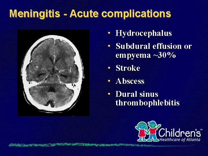 Meningitis - Acute complications • Hydrocephalus • Subdural effusion or empyema ~30% • Stroke