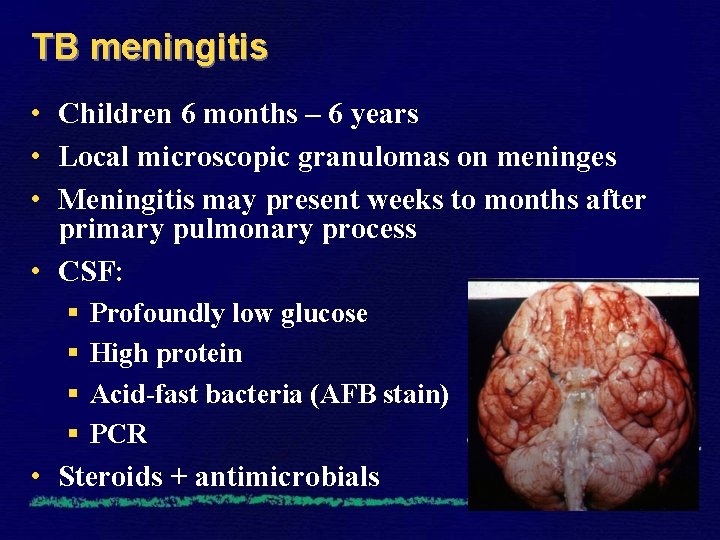 TB meningitis • Children 6 months – 6 years • Local microscopic granulomas on