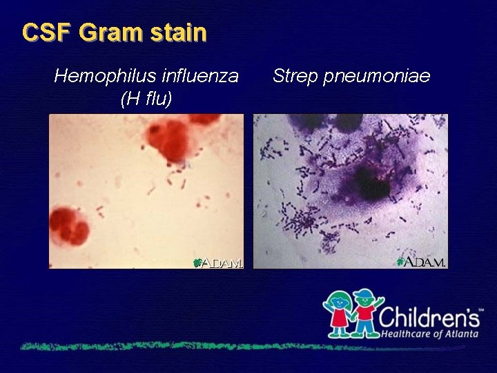 CSF Gram stain Hemophilus influenza (H flu) Strep pneumoniae 