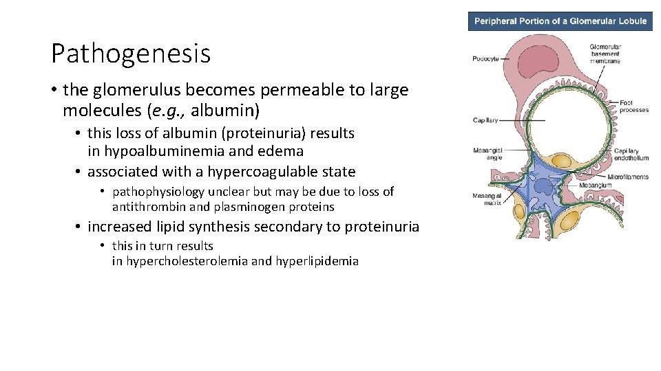 Pathogenesis • the glomerulus becomes permeable to large molecules (e. g. , albumin) •