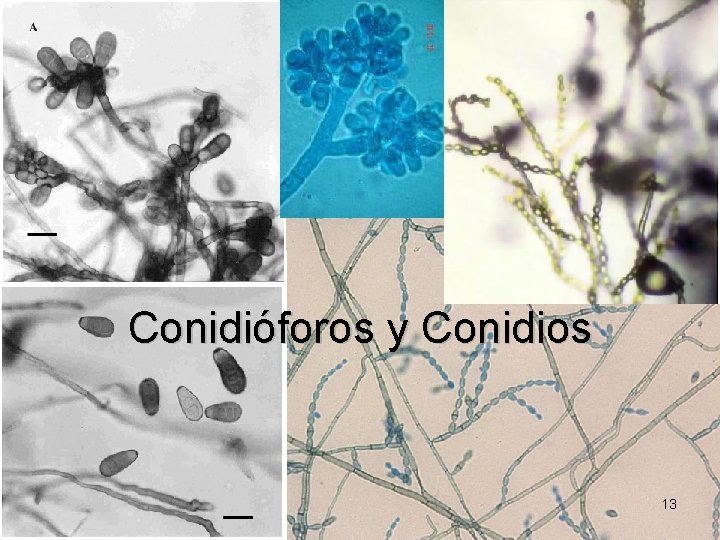 Conidióforos y Conidios 13 