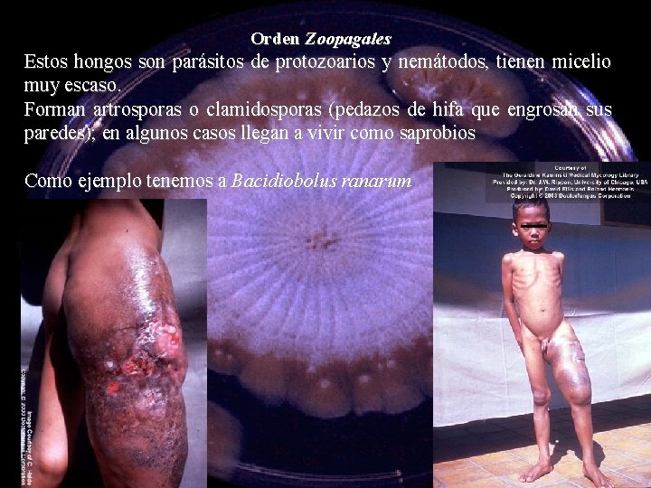 Orden Zoopagales Estos hongos son parásitos de protozoarios y nemátodos, tienen micelio muy escaso.