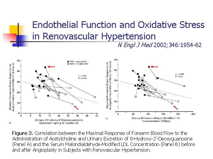Endothelial Function and Oxidative Stress in Renovascular Hypertension N Engl J Med 2002; 346: