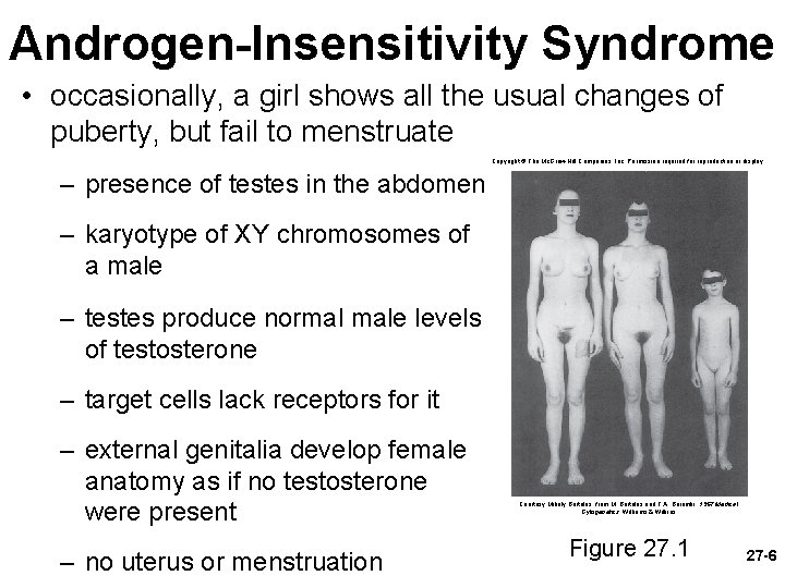 Androgen-Insensitivity Syndrome • occasionally, a girl shows all the usual changes of puberty, but